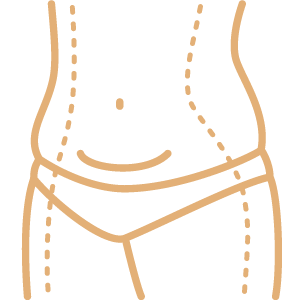 Endolift láser