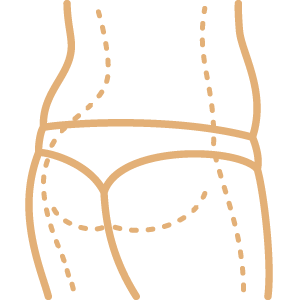 Sculptra en glúteos