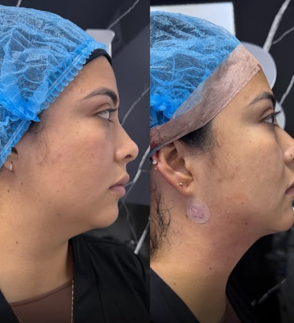 Lipopapada